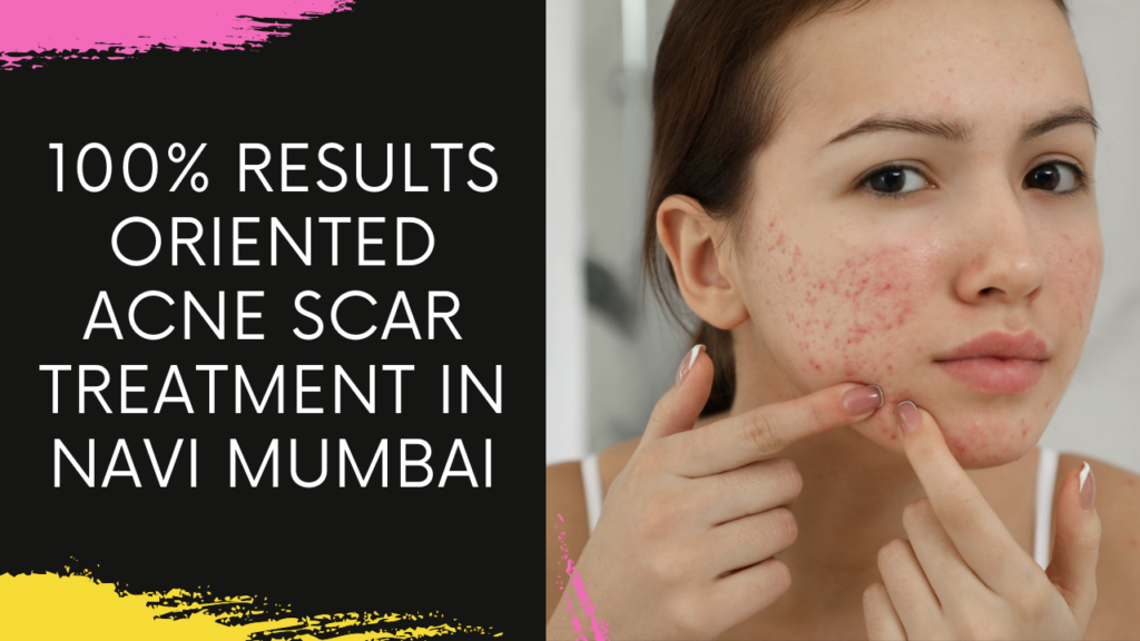 Acne Scar Removal Treatment in Navi Mumbai | The Cost Of Acne Scar Treatment In Navi Mumbai