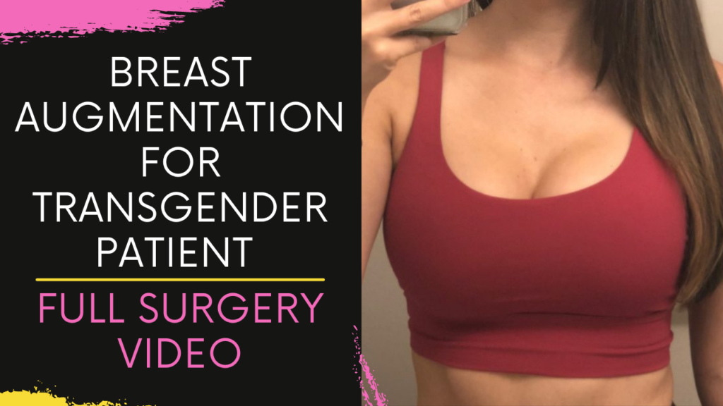 Breast Augmentation for Transgender patient Performed at Bodyskulpt Aesthetics in Navi Mumbai, India