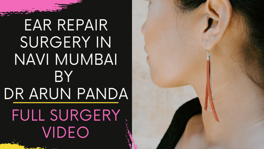 Ear Repair Surgery in Navi Mumbai | Ear Repair Surgery in Mumbai | Elongated Earlobe Surgery