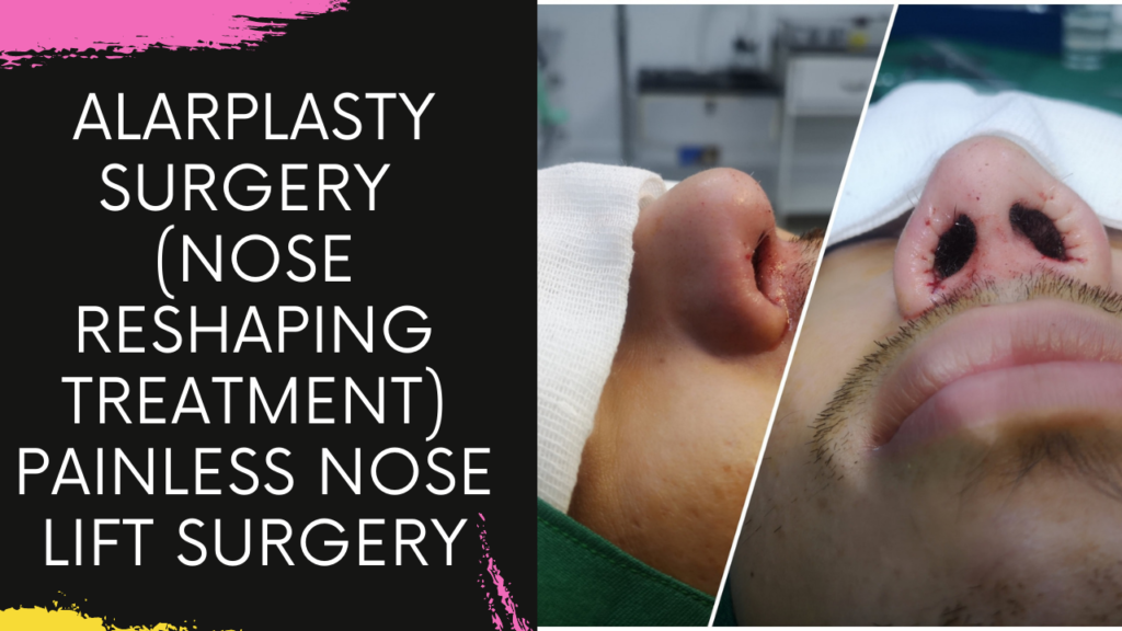 Alarplasty Nose Base Correction Surgery in Navi Mumbai by Dr Arun Panda