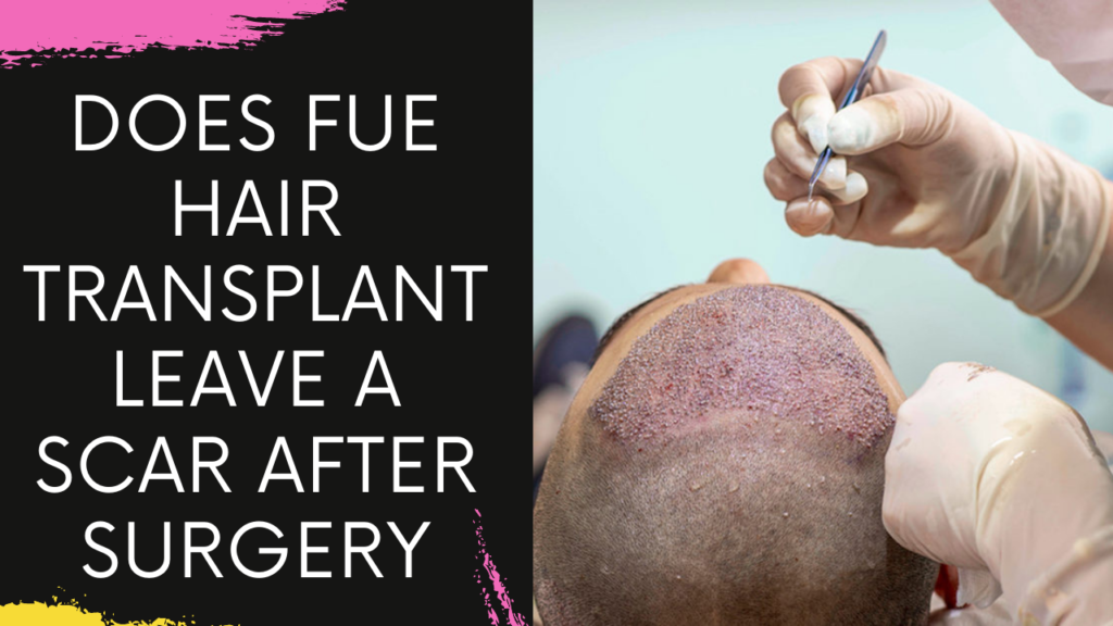 Does FUE Hair Transplant leave a scar after surgery explains Top Hair Transplant Surgeon in Mumbai
