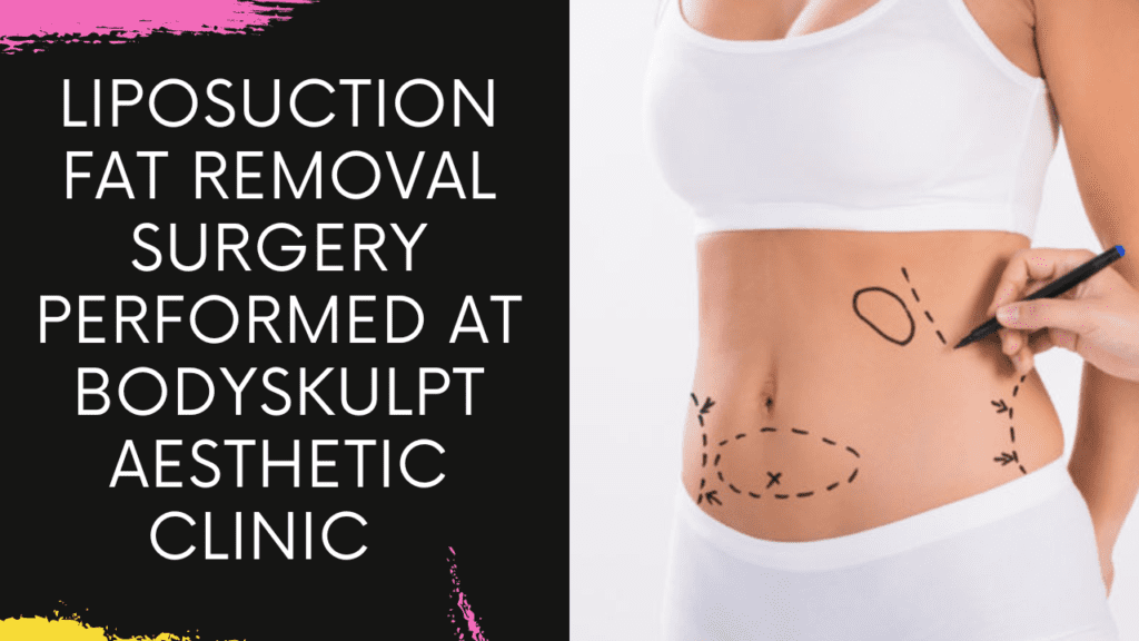Liposuction Fat Removal Surgery performed at Bodyskulpt Aesthetic Clinic in Navi Mumbai