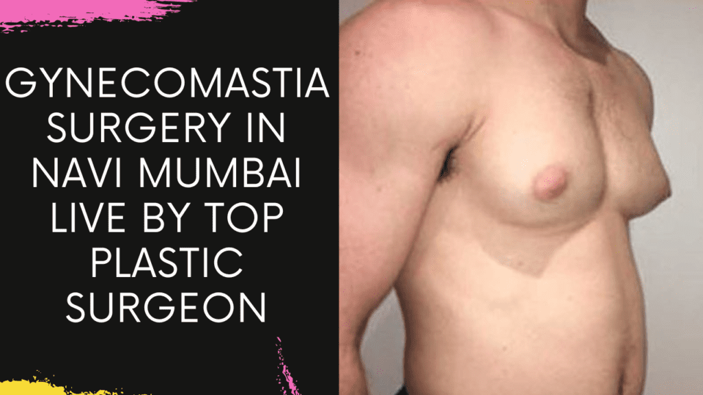 Gynecomastia Surgery in Navi Mumbai live by Top Plastic Surgeon at Bodyskulpt Aesthetics