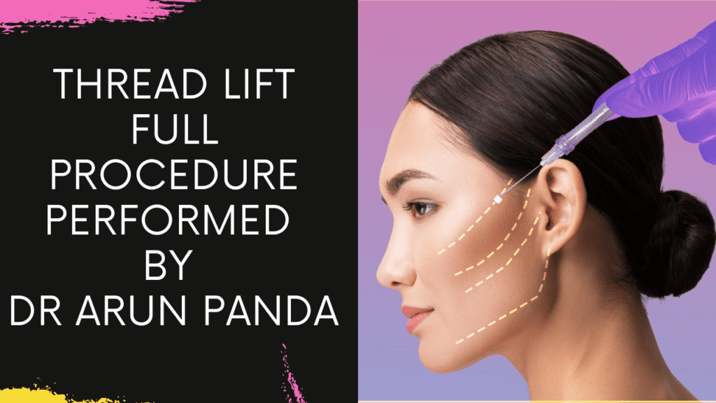 Thread Lift full Treatment | Procedure Performed by Dr Arun Panda Facial Plastic Surgeon
