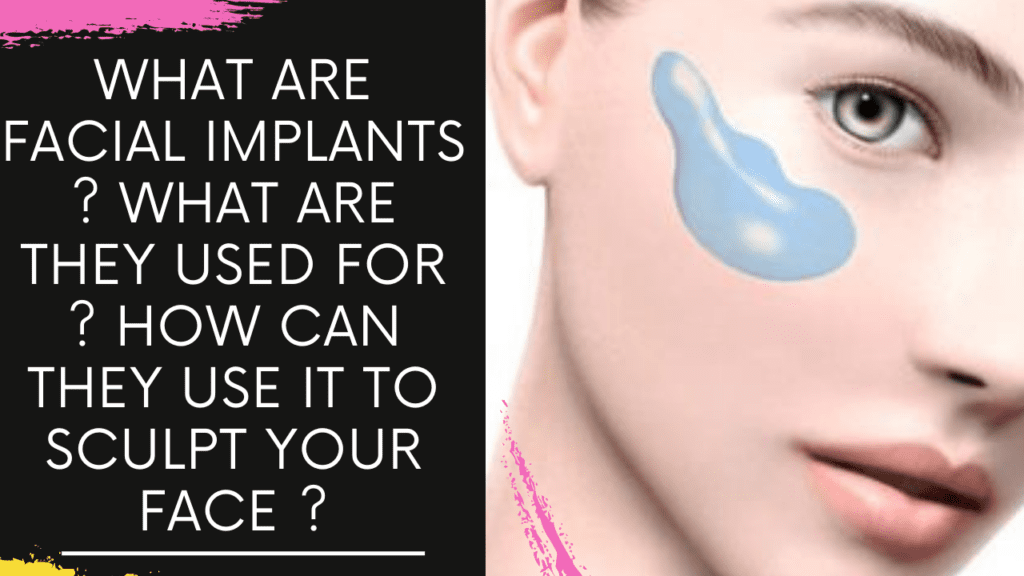 What are Facial Implants ? what are they used for ? How can they use to sculpt your face ?