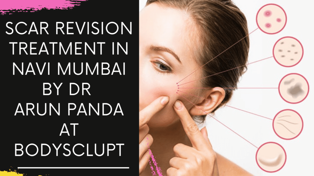 Scar removal Treatment in Navi Mumbai by Dr Arun Panda at Bodyskulpt
