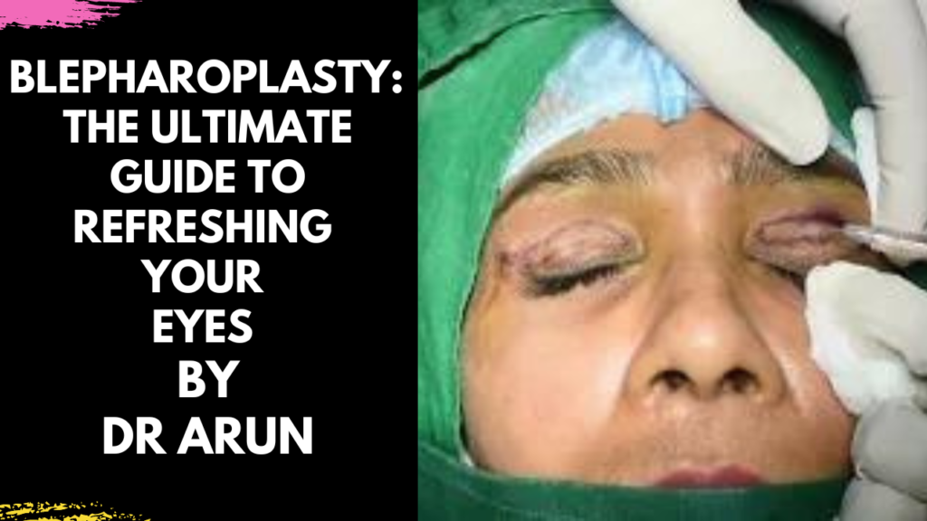 Blepharoplasty: Refresh Your Eyes by Dr Arun Panda