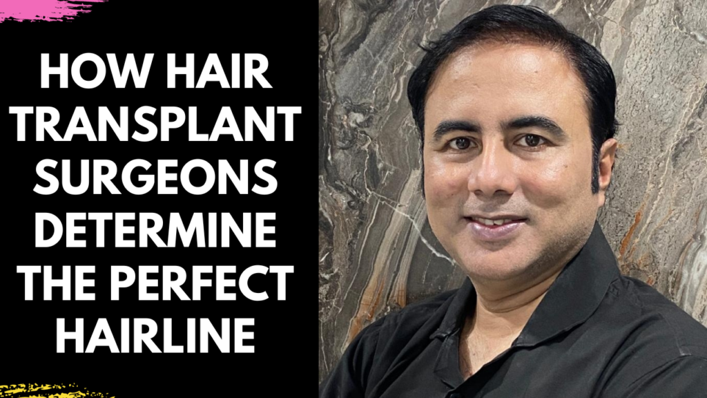 How Hair Transplant Surgeons Determine the Perfect Hairline