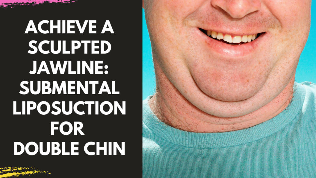 Achieve a Sculpted Jawline: Submental Liposuction for Double Chin in Mumbai by Dr Arun Panda