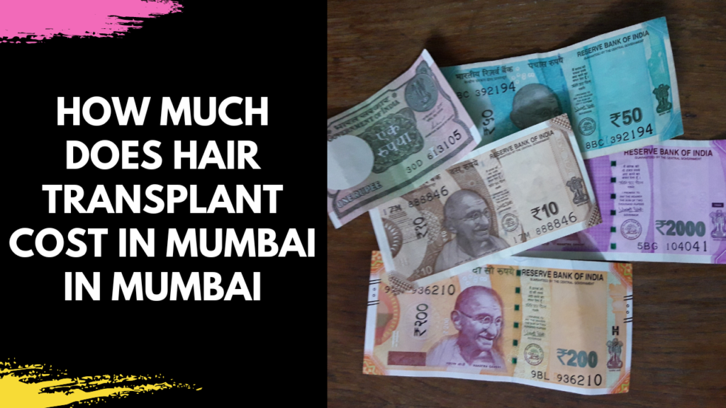 Understanding Hair Transplant Cost in Mumbai with Dr. Arun Panda