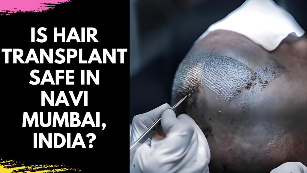 Is Hair Transplant Safe in Navi Mumbai, India?