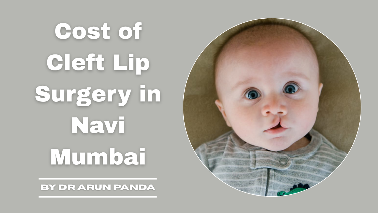 Cost of Cleft Lip Surgery in Navi Mumbai - Dr Arun Panda